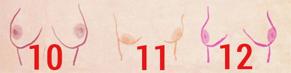 st4