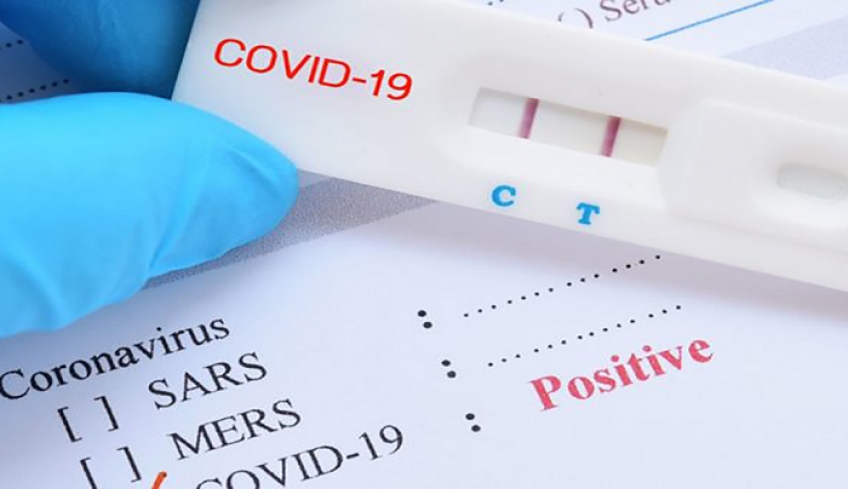 Τι αλλάζει για τα υποχρεωτικά rapid test στον ιδιωτικό τομέα