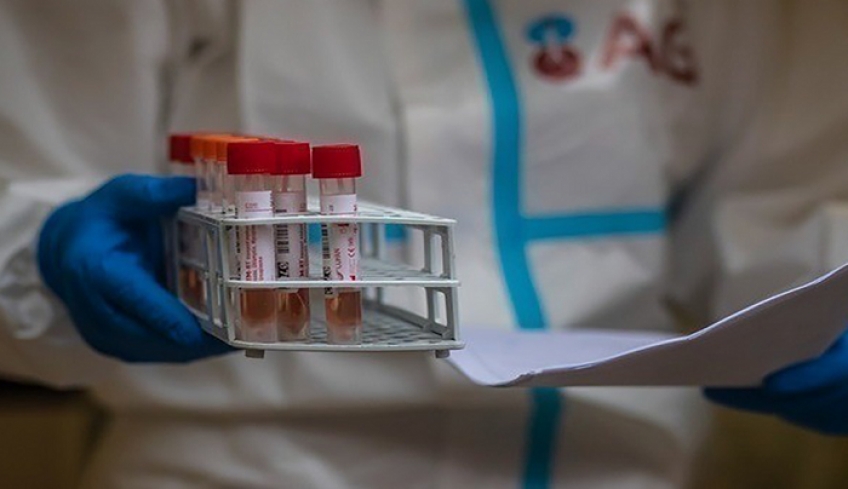 Κορωνοϊός – Μείωση καταγεγραμμένων κρουσμάτων λόγω Πρωτοχρονιάς – 17.633 νέα και 61 θάνατοι – Στους 626 οι διασωληνωμένοι