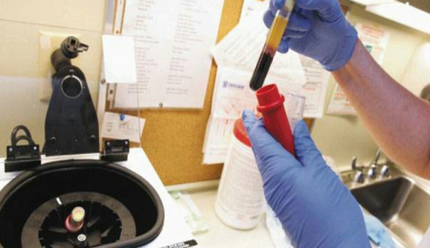 Σύστημα τεχνητής νοημοσύνης κάνει αξιόπιστες διαγνώσεις λευχαιμίας