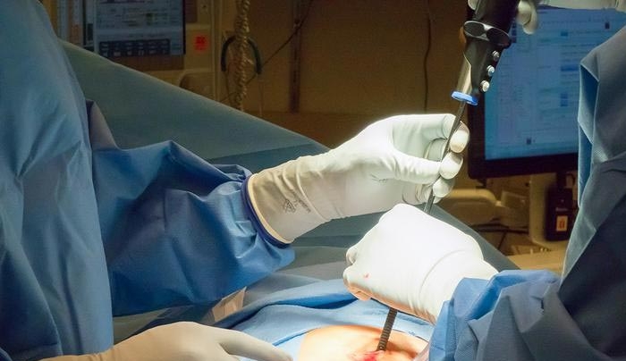 Ένα 16χρονο κορίτσι έκρυβε ένα μίνι-εγκέφαλο μέσα στην ωoθήκη της!
