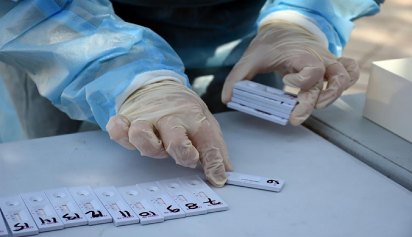 Κορωνοϊός: Καταγράφηκαν 15.909 νέα κρούσματα, 63 θάνατοι και 433 διασωληνωμένοι