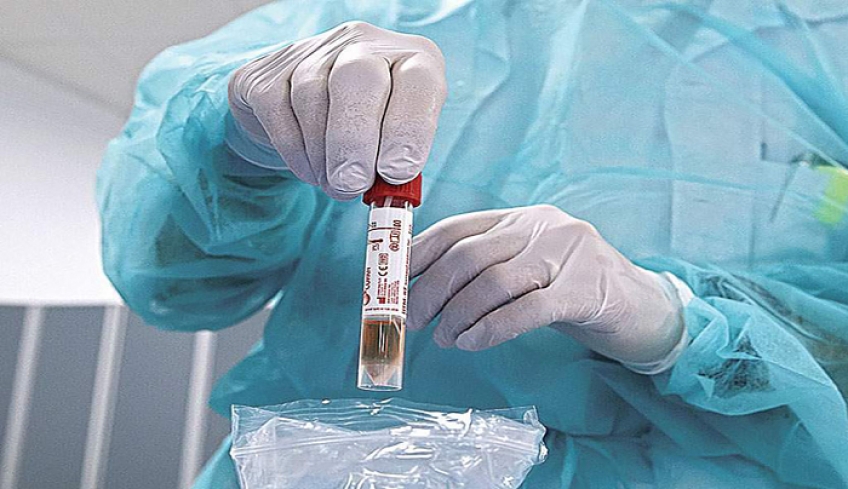 Κορωνοϊός: 11 νέα κρούσματα στην Π.Ε. Ρόδου!