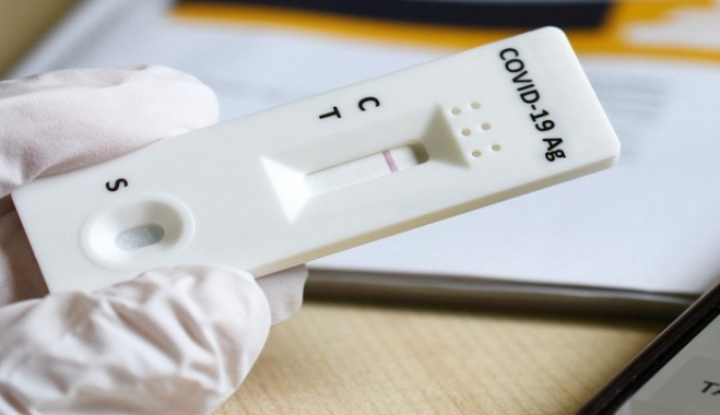 Μειώνονται τα self test στα σχολεία προανήγγειλε ο υπουργός Υγείας, Θάνος Πλεύρης