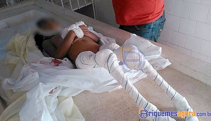 Πιράνχας κατασπάραξαν 6χρονο κοριτσάκι