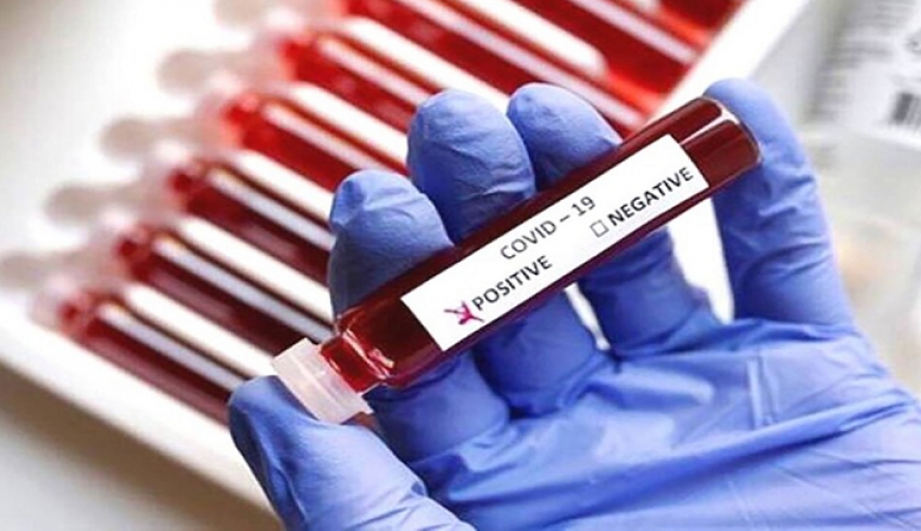 Κορωνοϊός – 18.869 νέα κρούσματα και 81 θάνατοι – Στους 688 οι διασωληνωμένοι