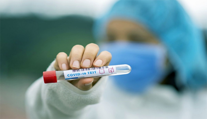 ΤΡΟΠΟΠΟΙΗΣΗ ΩΡΑΡΙΟΥ ΔΩΡΕΑΝ ΕΛΕΓΧΩΝ COVID -19 ΣΤΟ ΕΠΑΡΧΕΙΟ ΚΩ