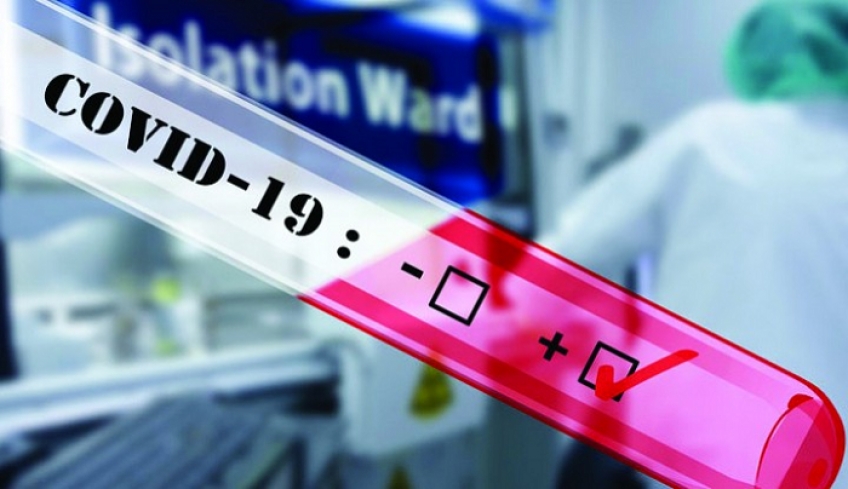 Προμήθεια rapid test για τους επισκέπτες των νησιών