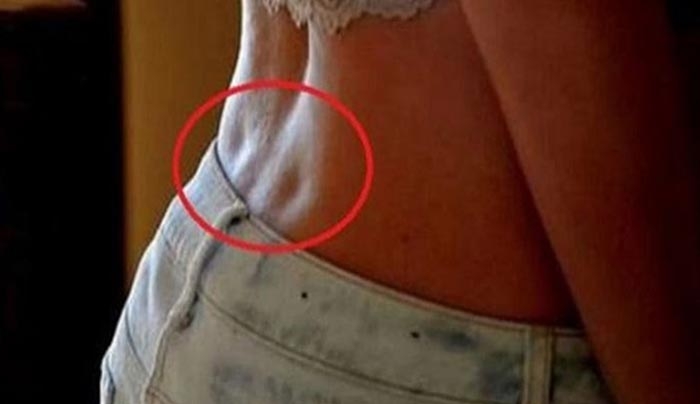 Εσείς έχετε Λακάκια στη Μέση σας; Αν ναι, δείτε ΤΙ σημαίνουν!