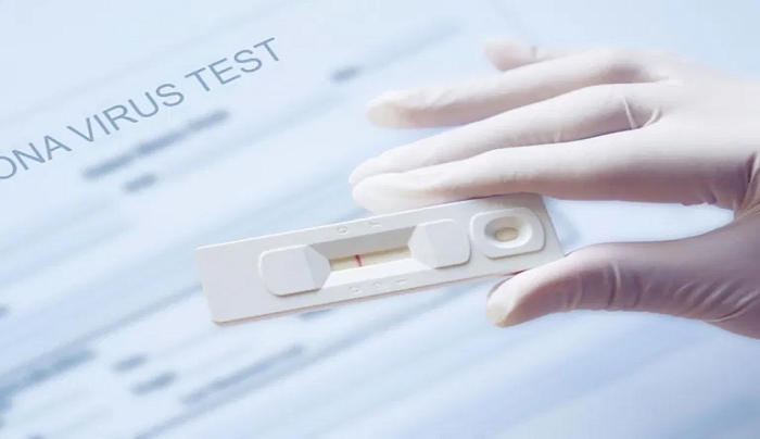 Self test: Υποχρεωτικά σε ξενοδοχεία, τουριστικά καταλύματα και ταξιδιωτικά γραφεία (ΦΕΚ)