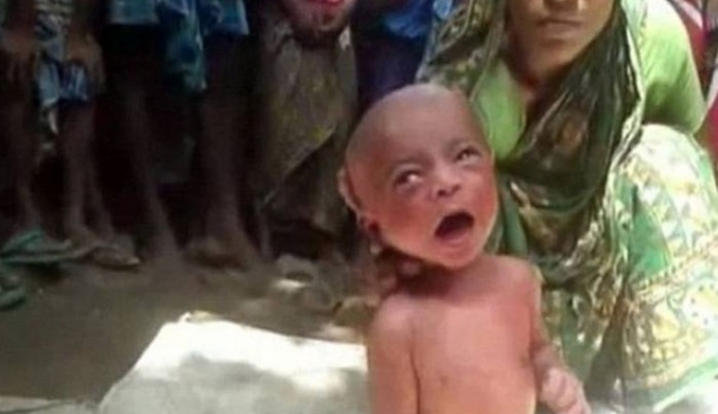 Σοκαριστικό βίντεο: «Μάγισσα-γιατρός» έβαλε βρέφος δύο ημερών να περπατήσει