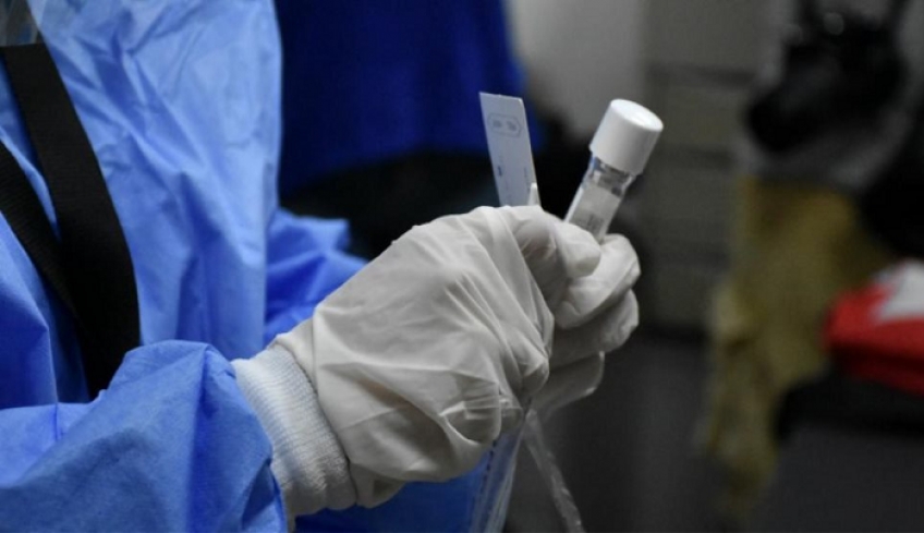 Γεγονός το πρώτο ελληνικό rapid test – Κατατέθηκε αίτηση για πατέντα