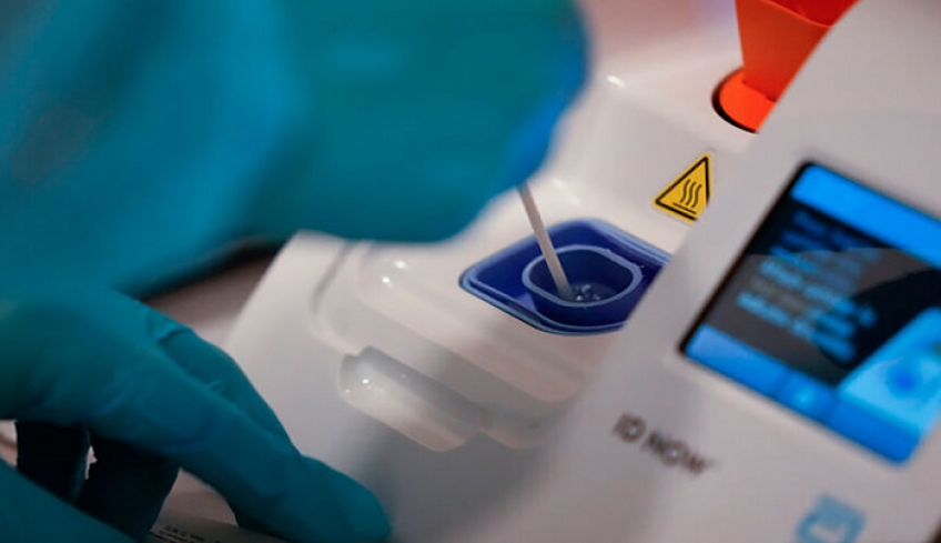 Τεστ PCR: Πλαφόν στα 47 ευρώ από την Πέμπτη