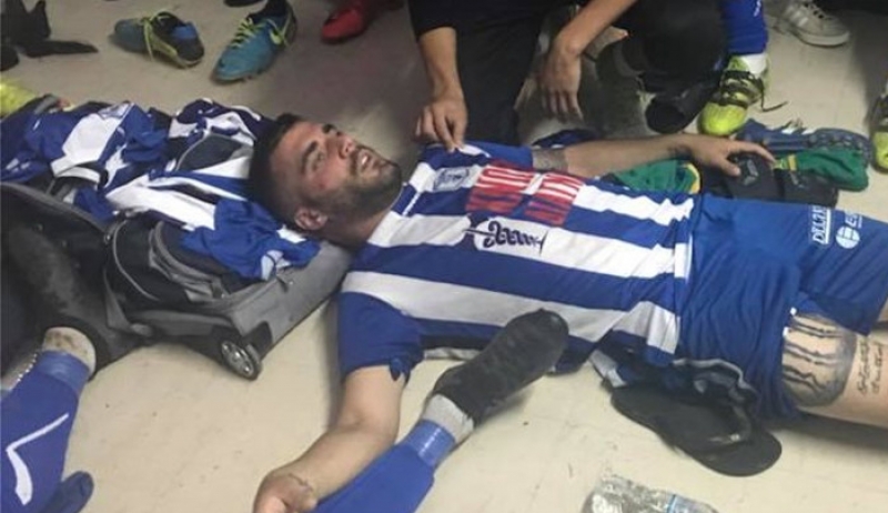 Οπαδοί του Αστέρα Αμαλιάδας ξυλοκόπησαν προπονητή και παίκτες του Ηρόδοτου
