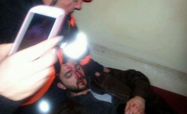 Δακρυγόνα, ξύλο και πανικός στην Τουρκία για τον θάνατο 15χρονου που υπέκυψε στα τραύματα του